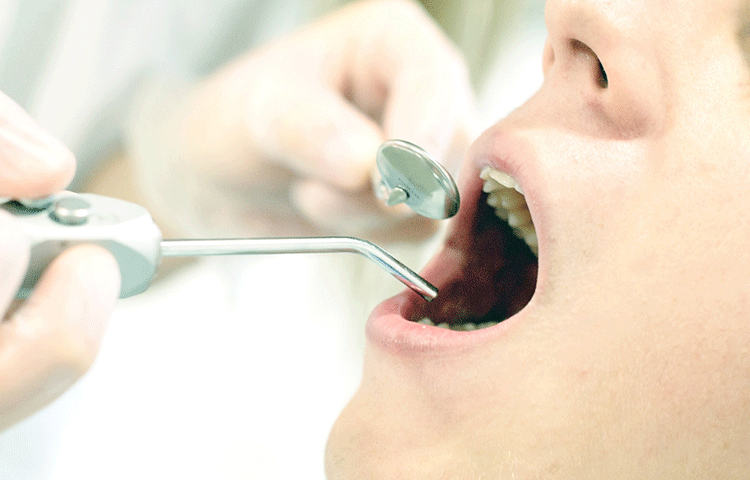 今ある歯を大切に、歯を残す治療を行います